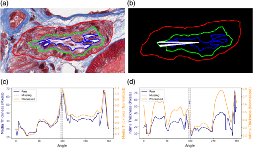 JMI_11_5_057501_f003.png